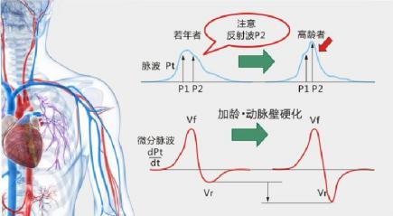 动脉脉波检测仪原理