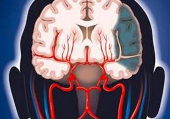 脑缺血灶能治好吗