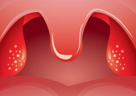 扁桃体发炎了怎么办