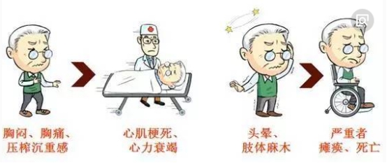 轻度脑梗死护理措施