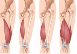 大腿肌肉拉伤原因有哪些
