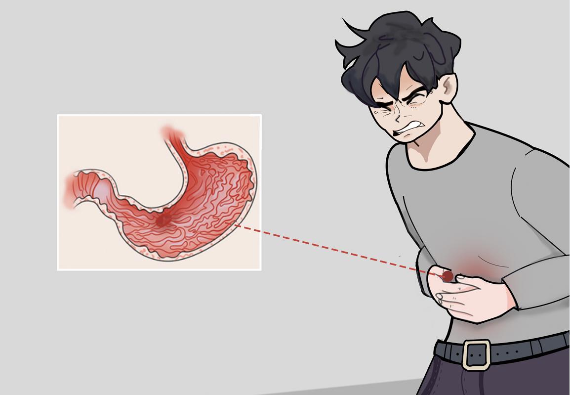 胃溃疡的症状有哪些，一不小心便成癌，千万要注意了！