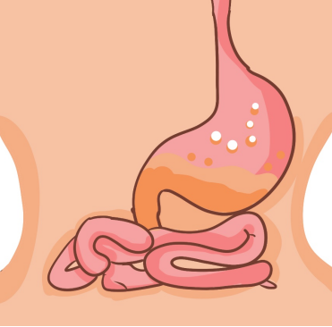 蒙脱石散治肠胃炎拉肚子怎么样？饮食上注意哪几方面？