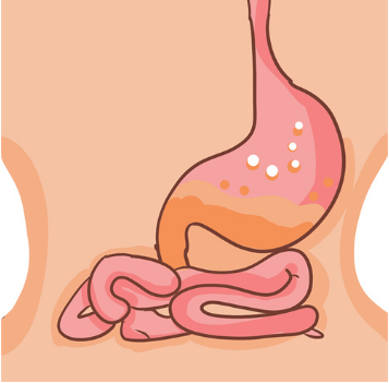 肠炎宁片治拉肚子吗？怎么样预防拉肚子出现？
