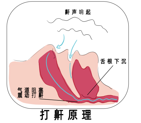 药店有卖打呼噜的药吗？吃什么药管用？