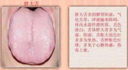 脾虚腹泻怎么辩证