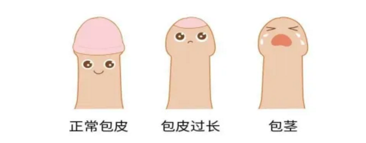 连云港治疗男科医院-连云港做包皮手术哪家医院好
